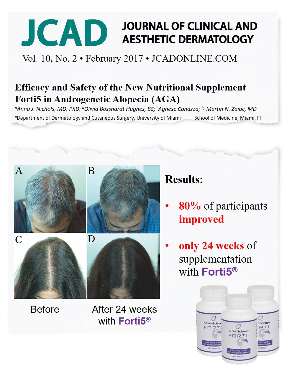 Quintessence Forti5 capsules close-up shows smooth texture for easy swallowing