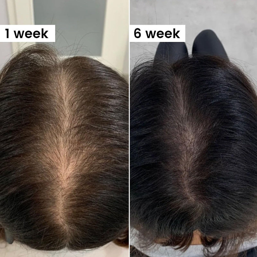 QUZOYU Thicair suitable for all hair types in compact packaging