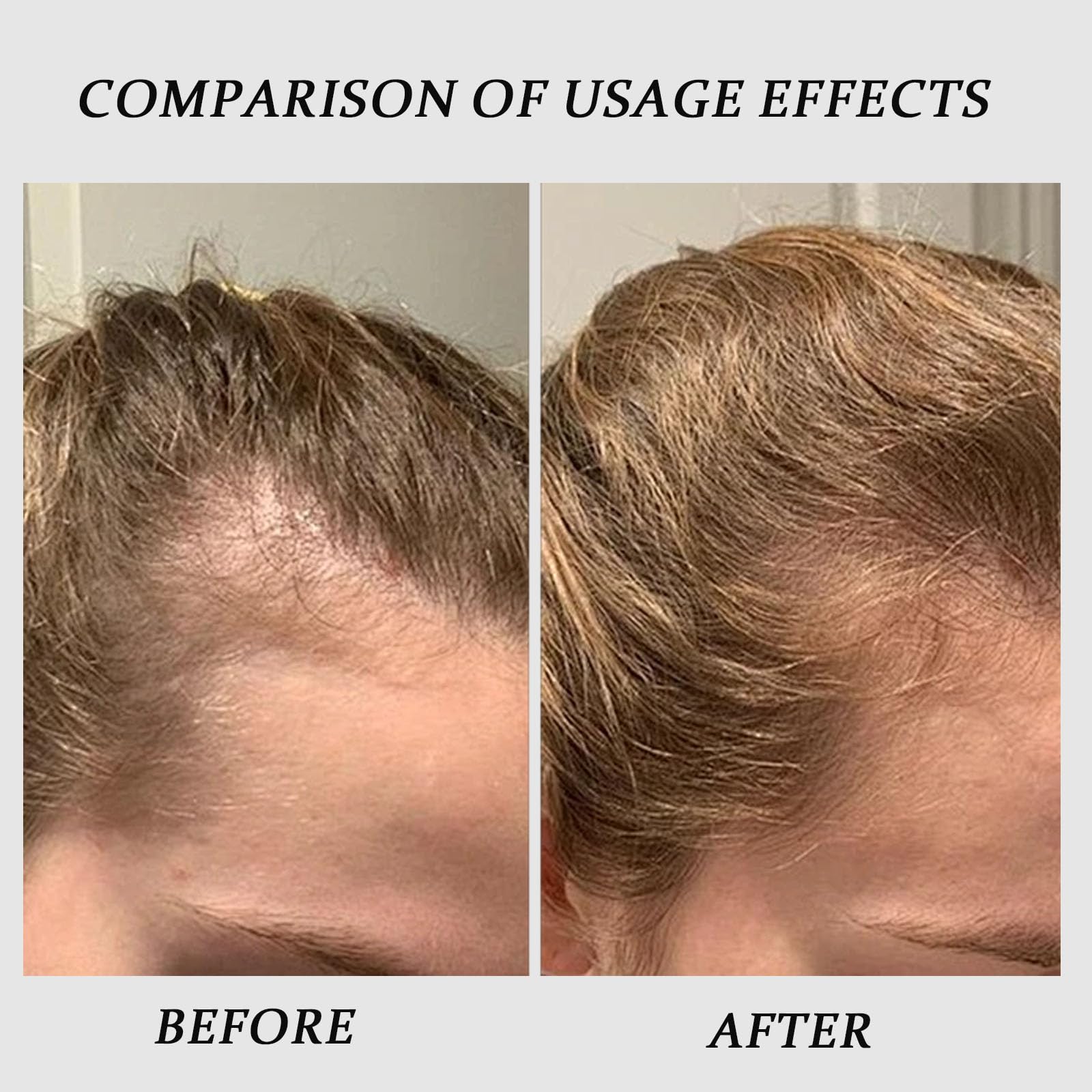 QUZOYU Thicair with copper peptides supports density in hair