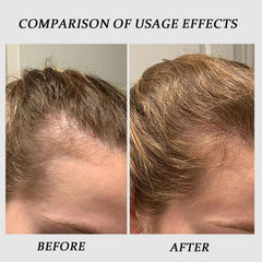 QUZOYU Thicair with copper peptides supports density in hair