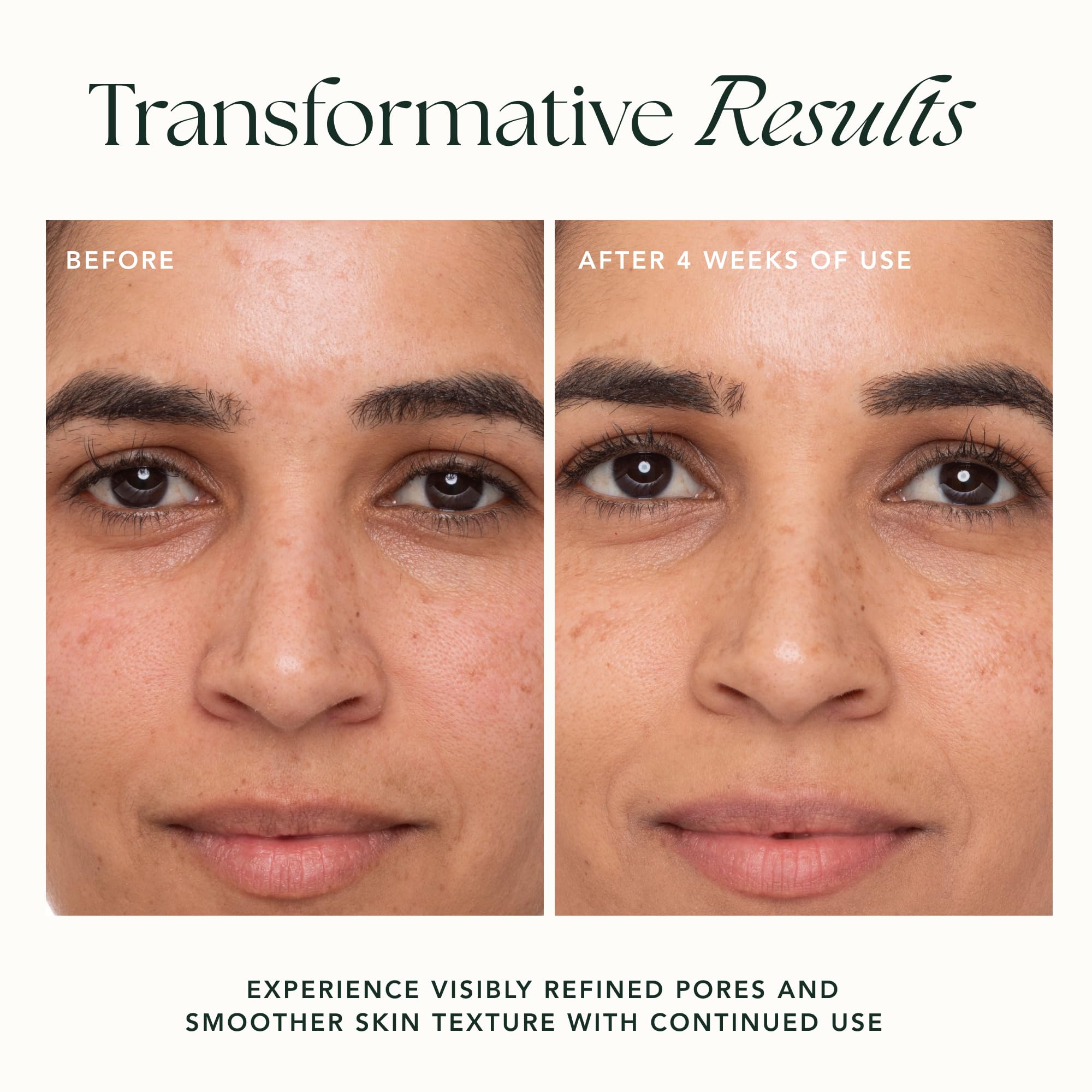 RANAVAT Botanics Refining Lotus Gel Cream drops – plump, hydrated skin with hyaluronic support.