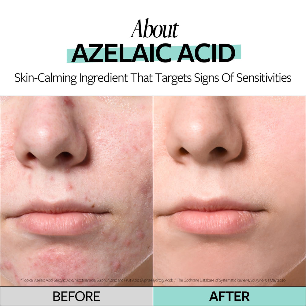RE:CIPE Azelaic Acid 10% soothing ampoule dropper release illustration for easy daily dosing