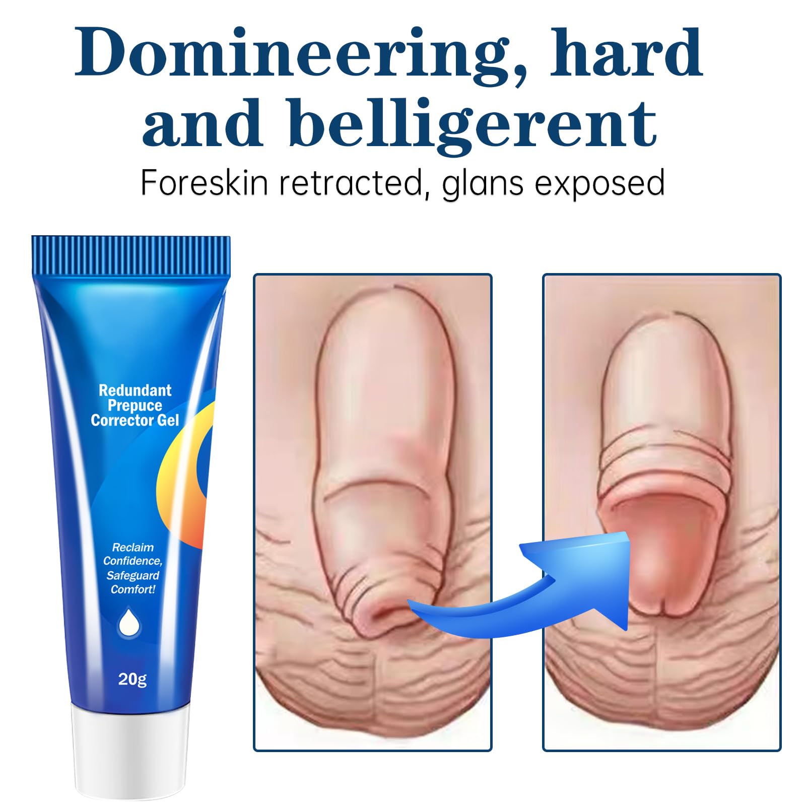Redundant Prepuce Corrector Gel packaging-2pcs illustrates value and kit convenience.