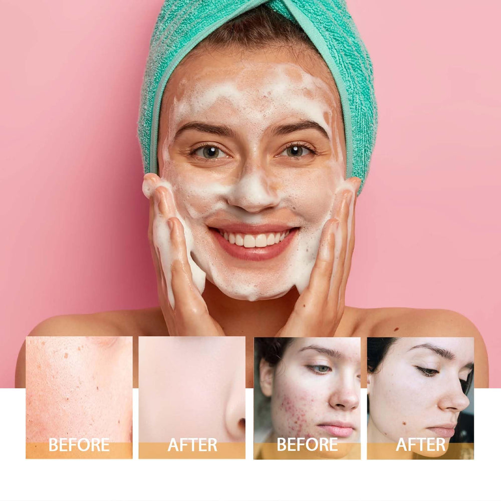 Water rinse ready shot with Reepic Cosmer Turmeric Cleanser on skin.
