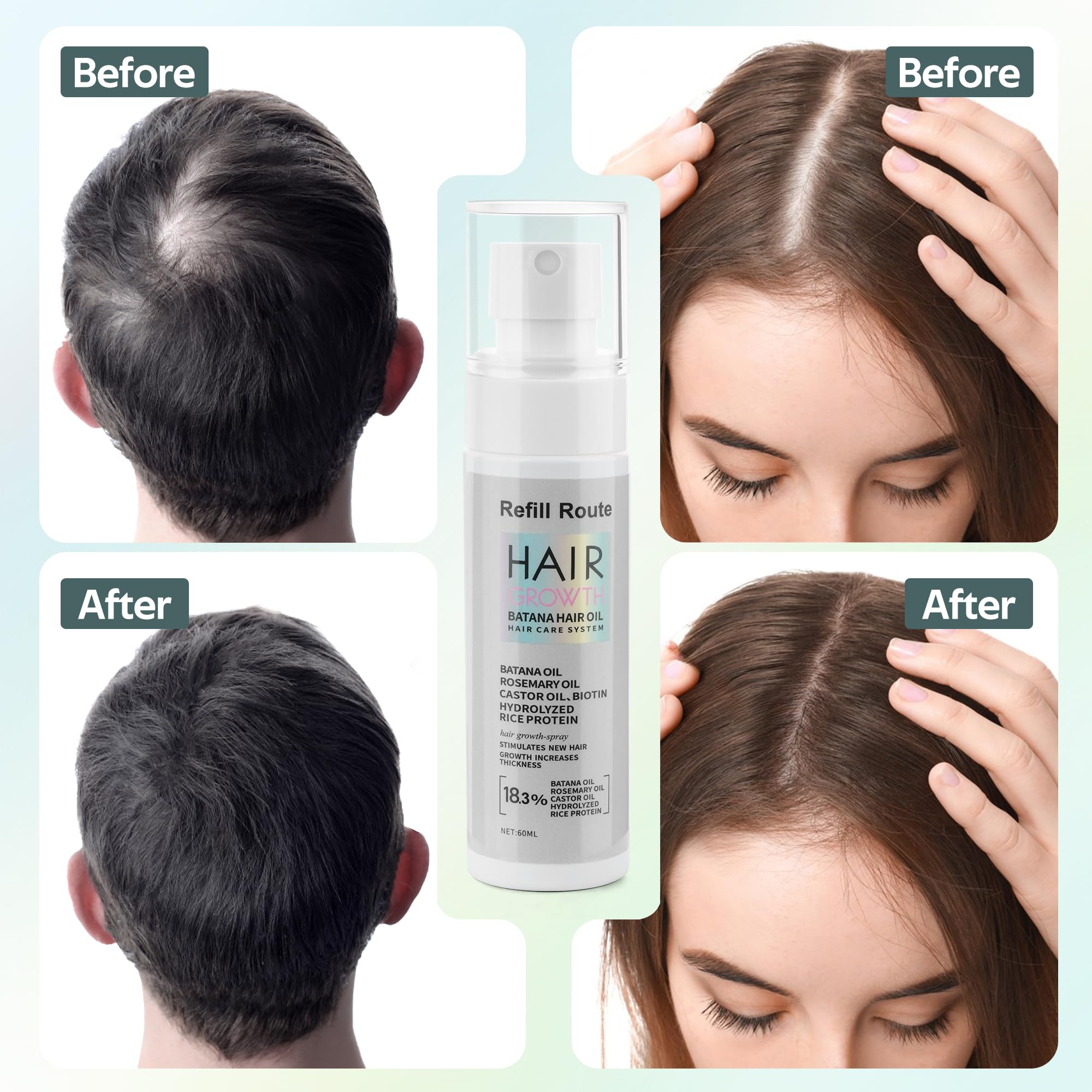Refill Route Batana Oil spray on scalp for targeted nourishment