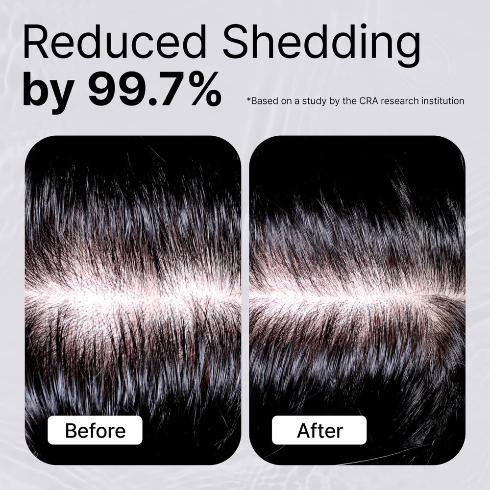 Refilled Booster Plus Moisture serum being applied to the scalp for fuller-looking results.