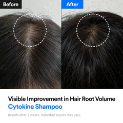Foam from Refilled Hair-Recovery Cytokine Shampoo forms a gentle, cleansing lather.
