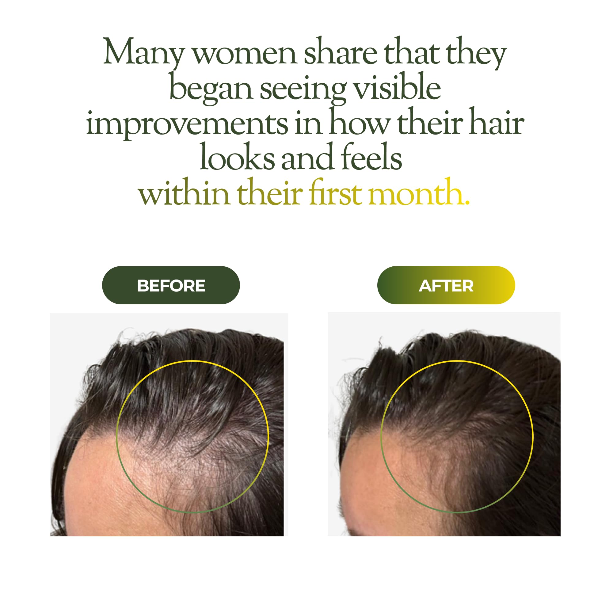regener8 scalp massage frame depicts a relaxing routine for hair care