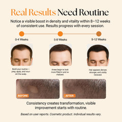 ReGlow plant exosome-like vesicles and botanicals for scalp vitality