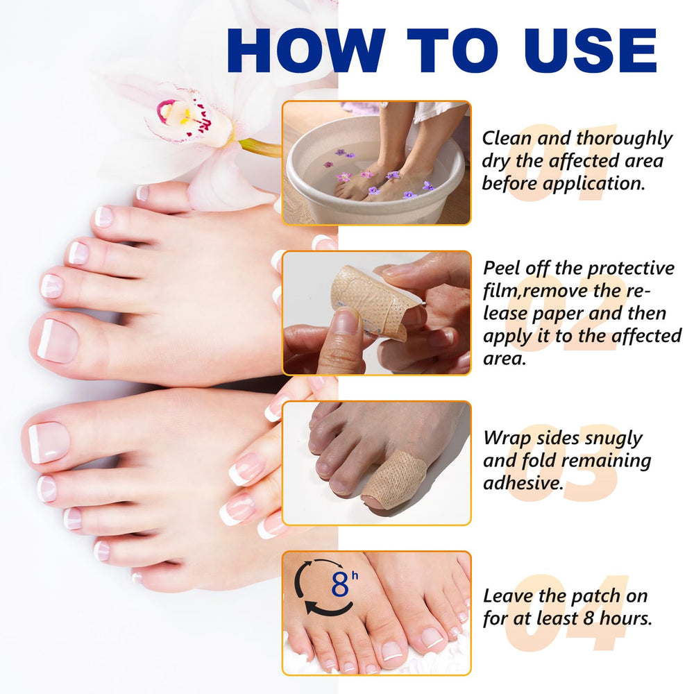 ReliCo patches described as a solution to address infections on nails.