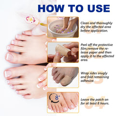 ReliCo patches described as a solution to address infections on nails.