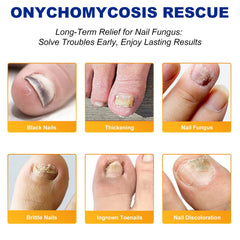 ReliCo waterproof adhesive keeps patches in place during the day.