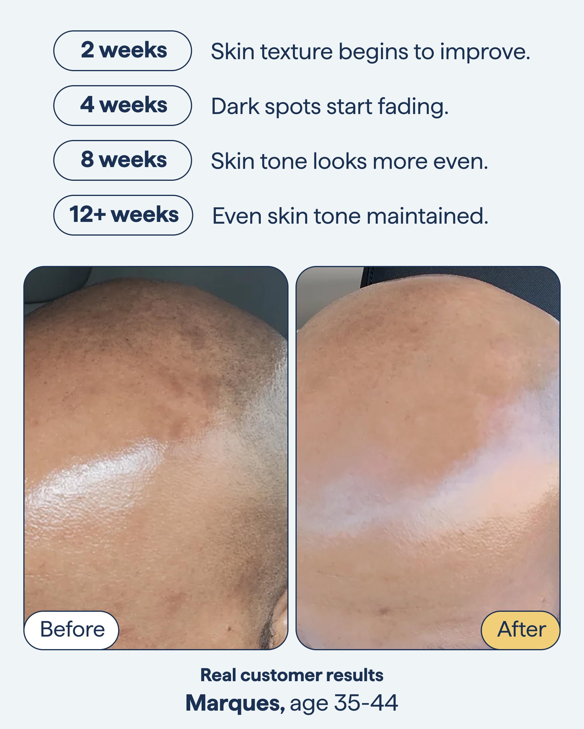 Remedy Science encapsulated retinol close-up for spot fading