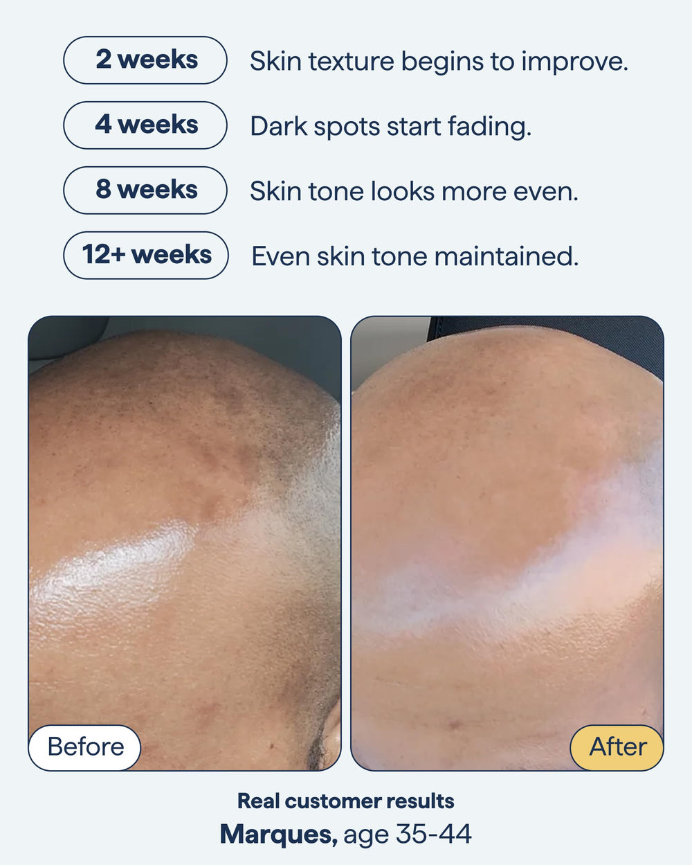 Remedy Science encapsulated retinol close-up for spot fading
