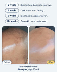 Remedy Science encapsulated retinol close-up for spot fading