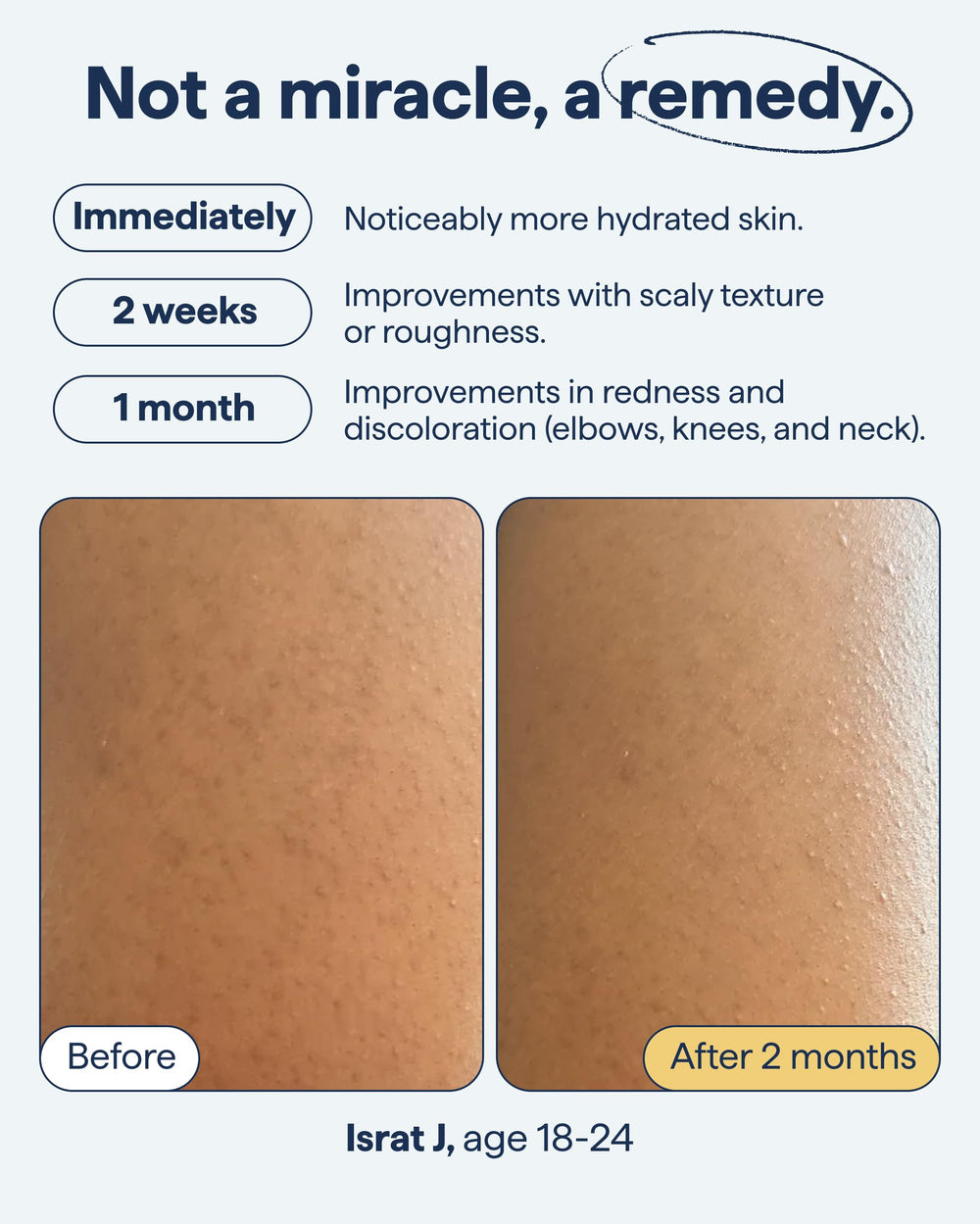 Creamy Remedy Science KP Exfoliating Body Moisturizer bottle easing dryness
