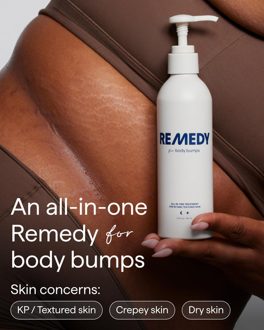 Close-up of Remedy Science KP Exfoliating Body Moisturizer texture for smoother skin