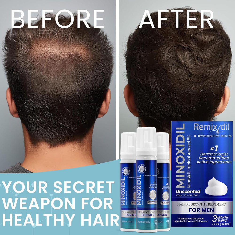 Remixidil easy-to-use applicator provides mess-free application.
