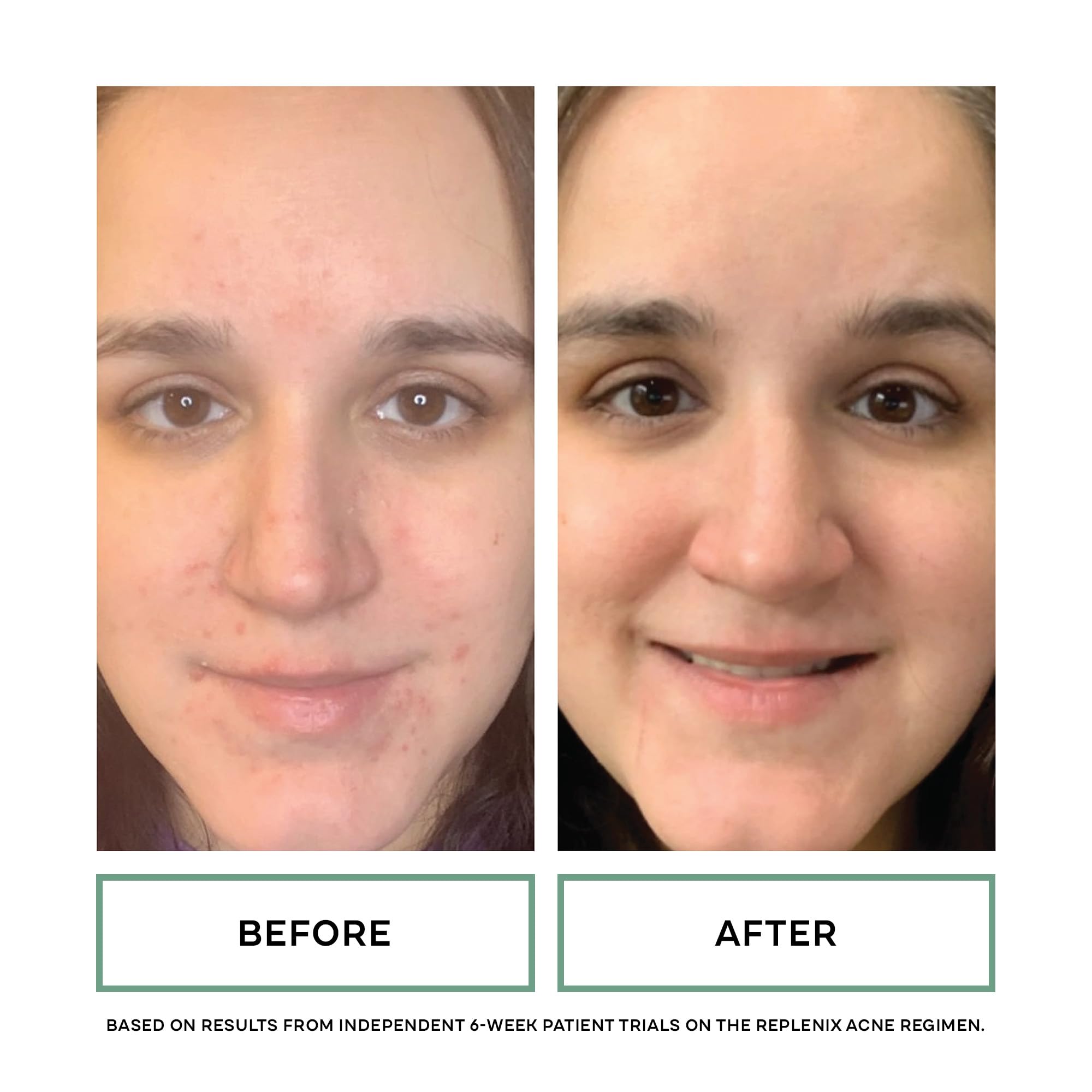 Green Tea Polyphenol Technology in Replenix Gentle Cleanser provides antioxidant support.