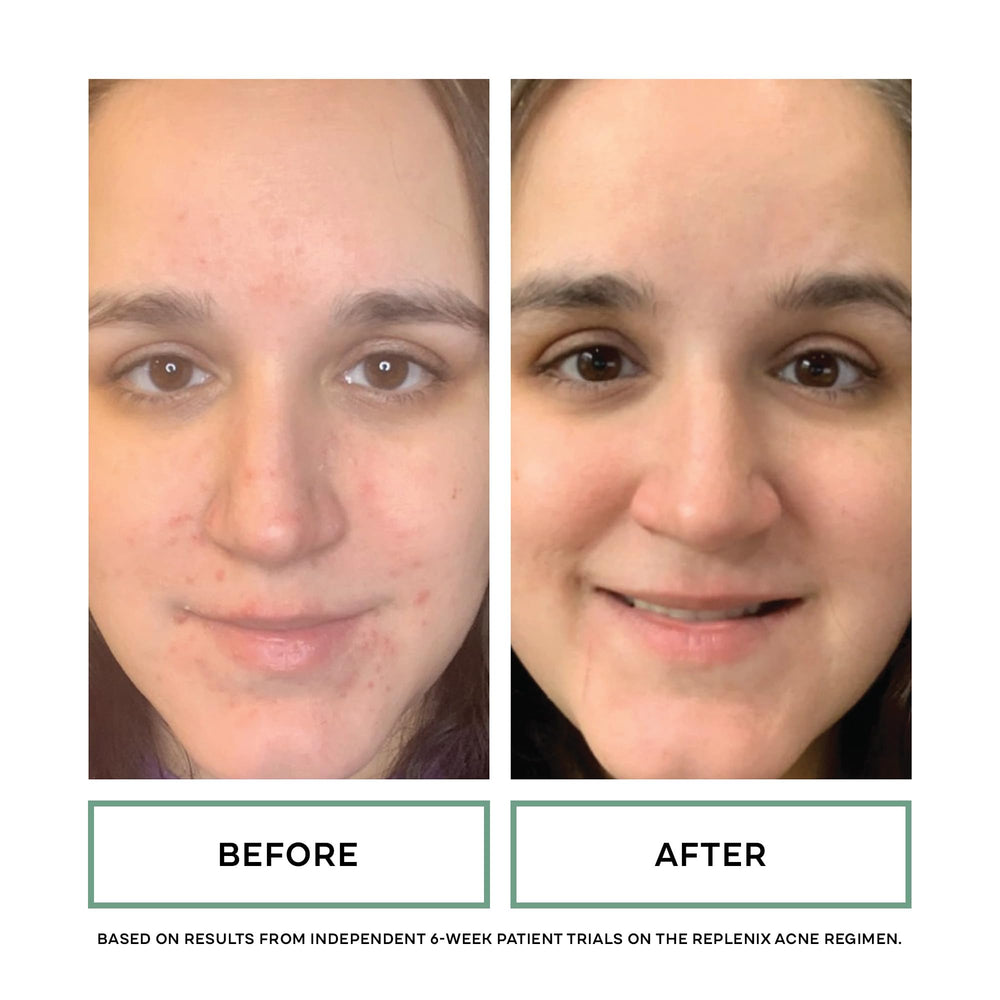 Green Tea Polyphenol Technology in Replenix Gentle Cleanser provides antioxidant support.