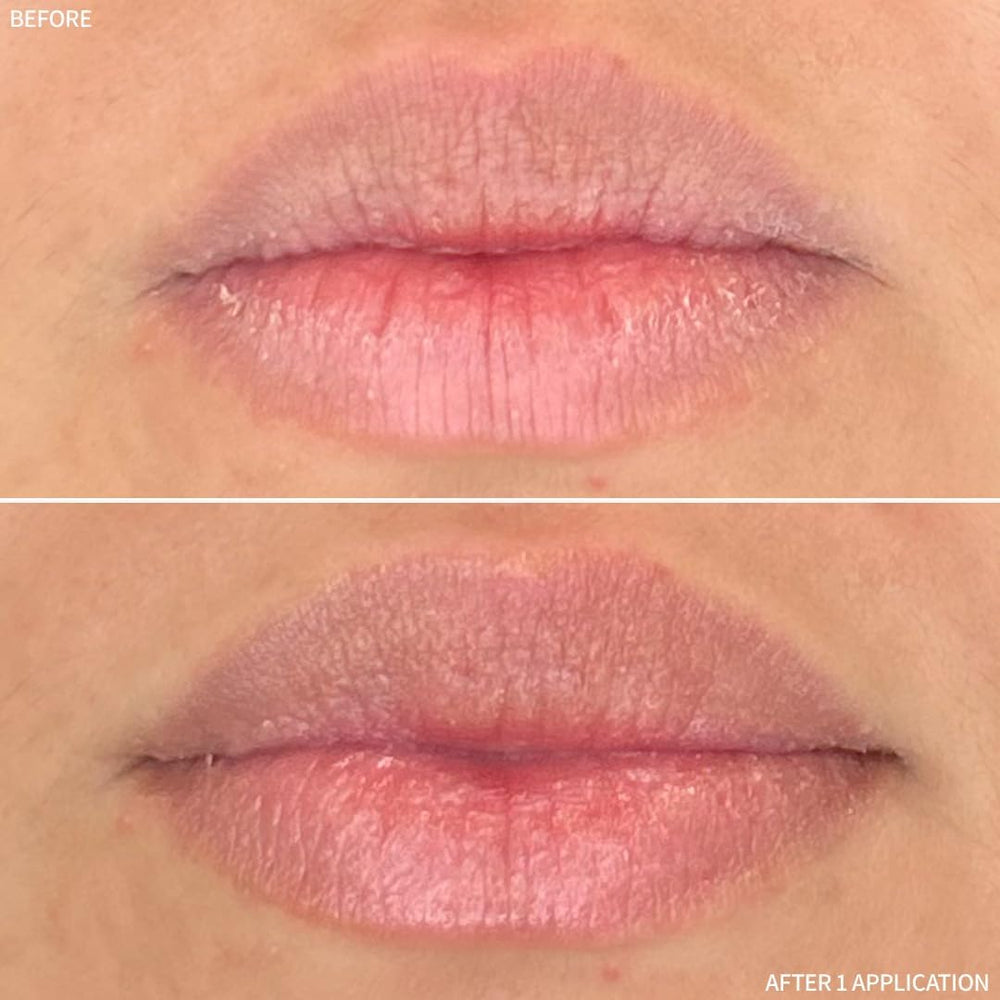 RescueMD biomimetic peptides suggesting collagen-like enhancement for smoother texture