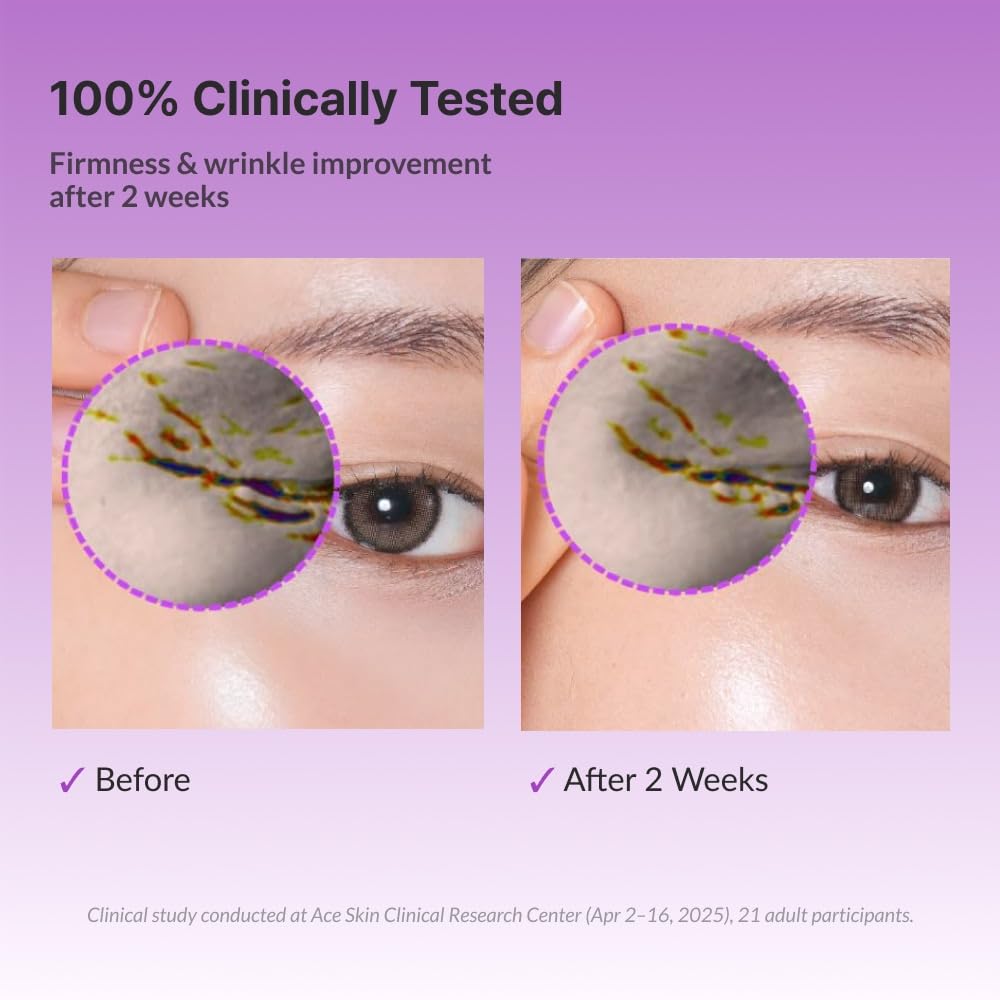 Returnu The Firm Eye Cream under-eye area during application
