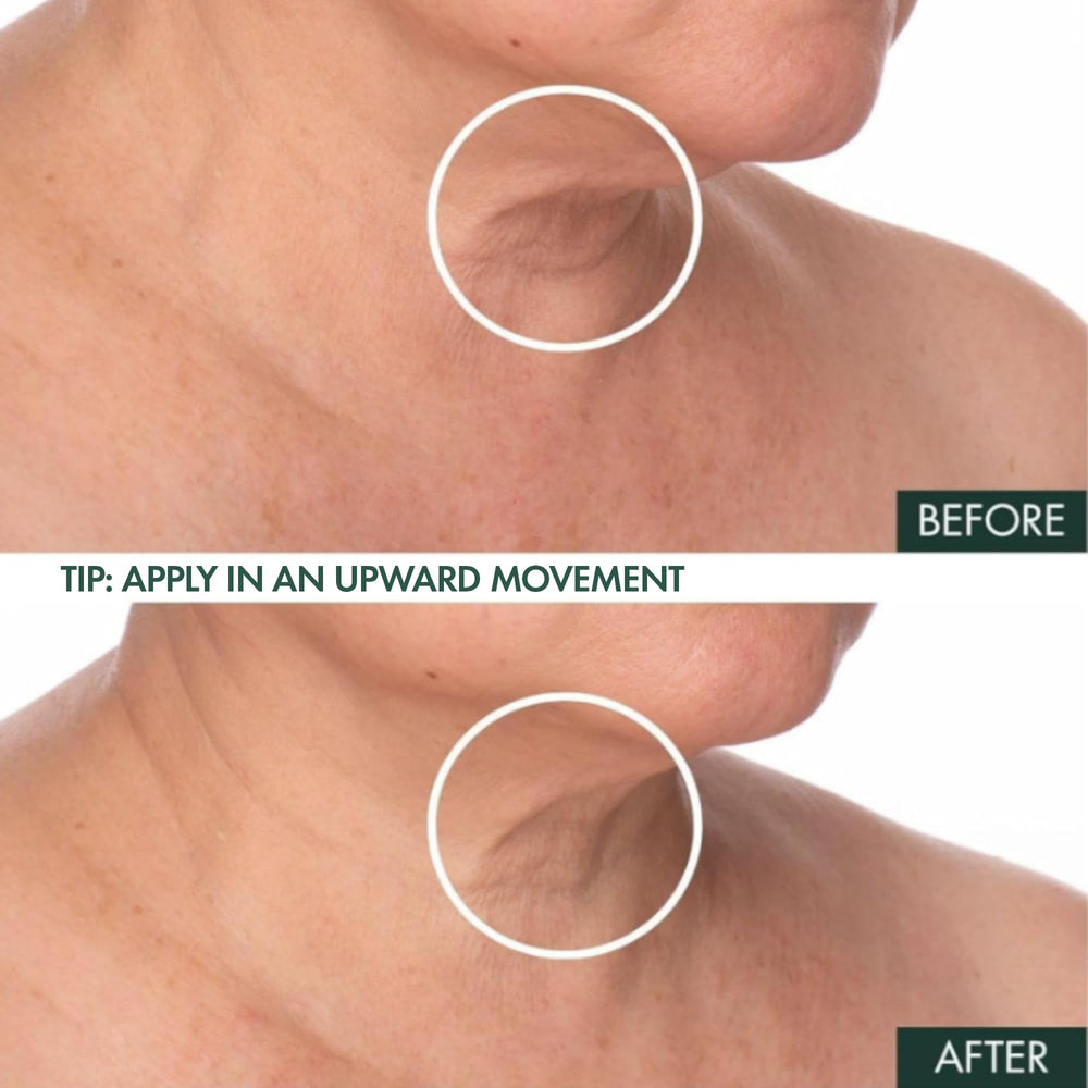 RéVive Fermitif neck serum featuring Bio-Renewal peptide and CoQ10.