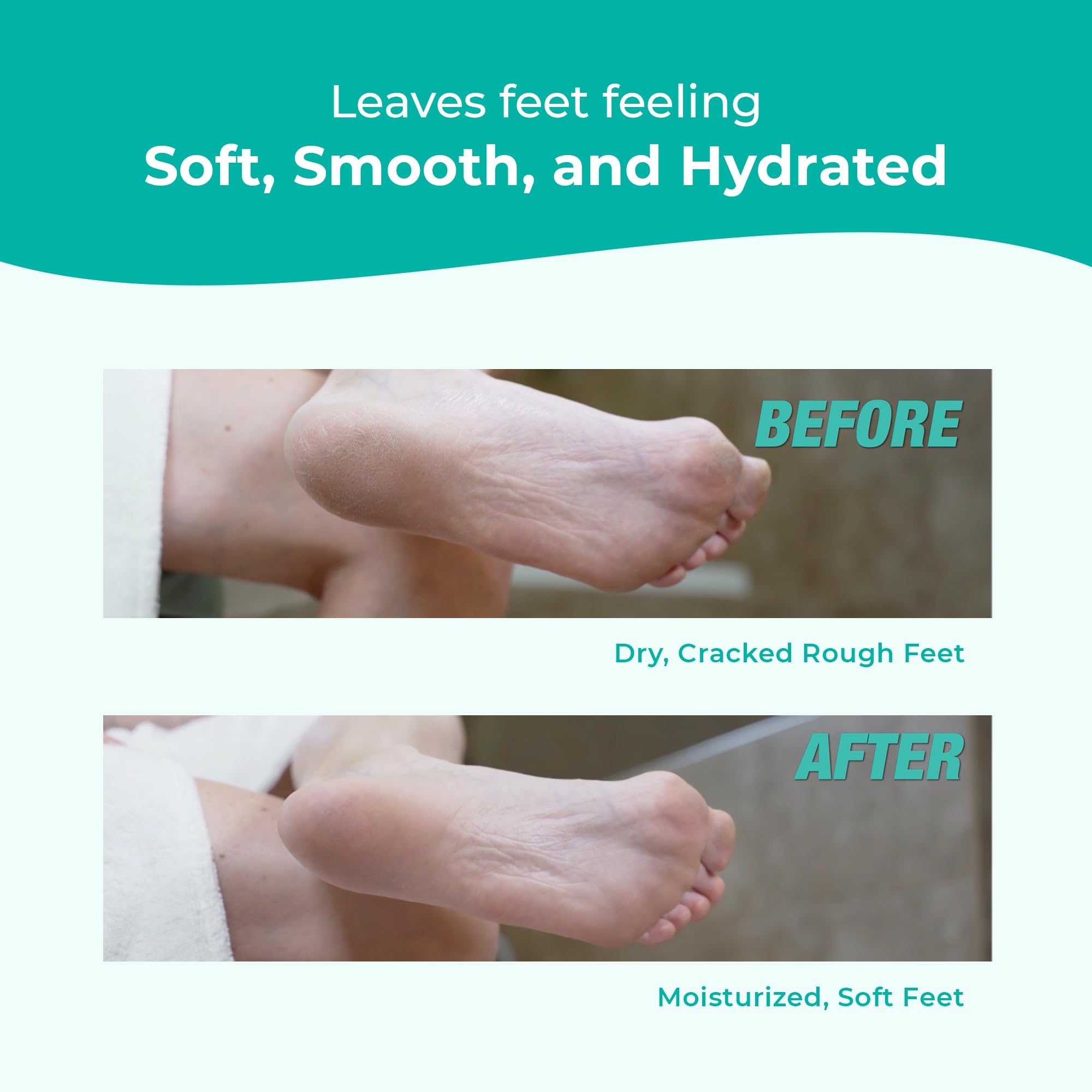 Richenna EZ Foot Cream ingredients map highlighting citrus extracts and urea benefits.