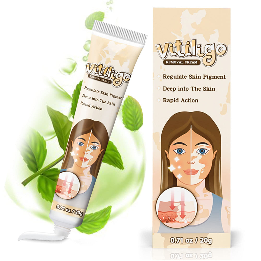 Richie House Vitiligo Cream bottle for easy nightly application