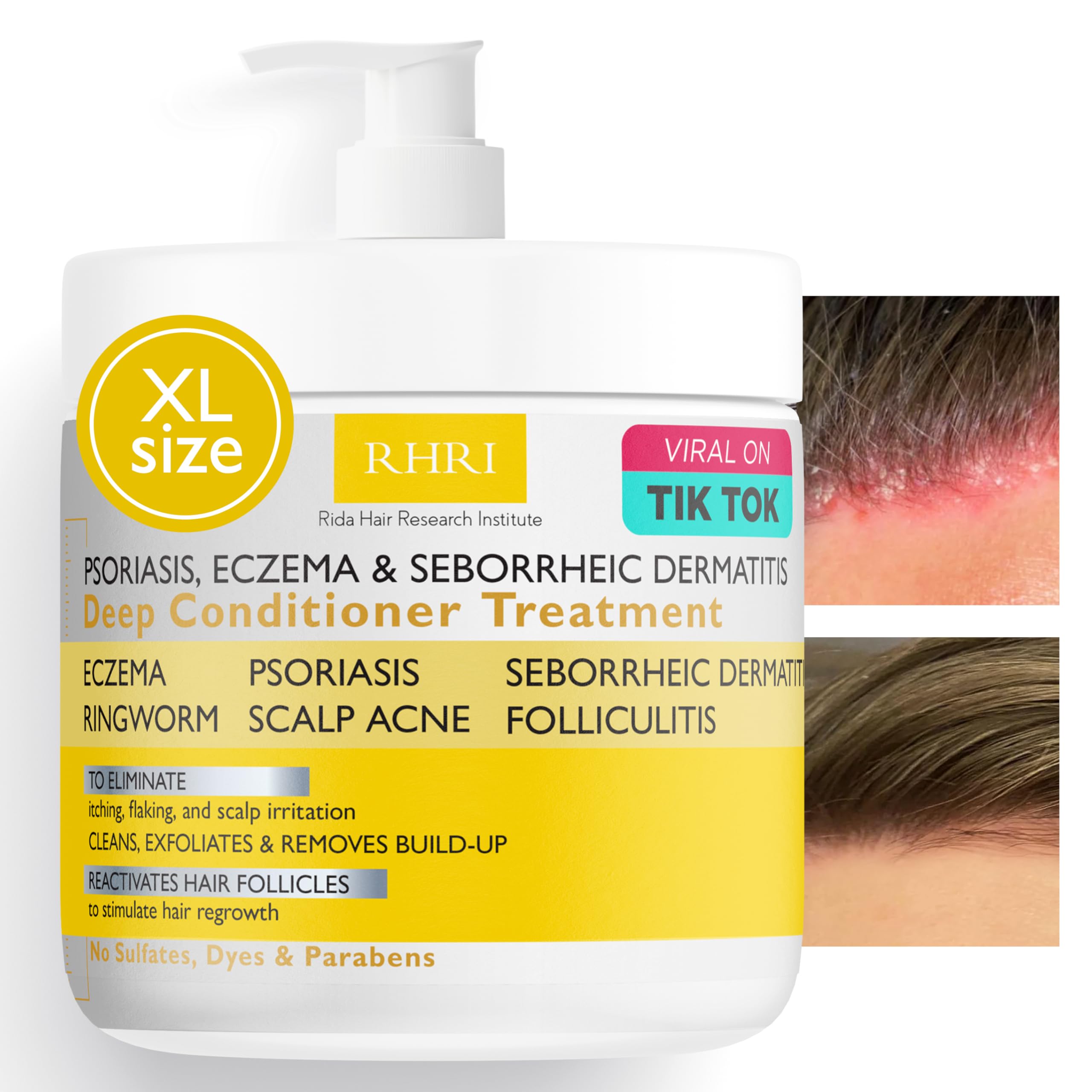 Rida Hair Research Institute anti fungal conditioner bottle pour for soothing scalp