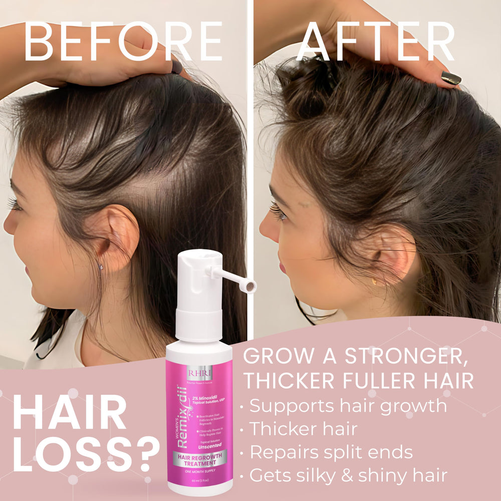 Rida Hair Minoxidil 60ml display emphasizes compact supply.