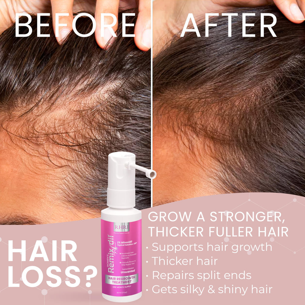 Rida Hair Minoxidil bottle in use for daily routine.