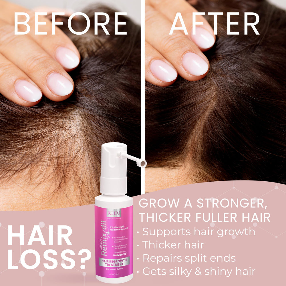 Rida Hair Minoxidil scalp close-up showing thinning areas care.