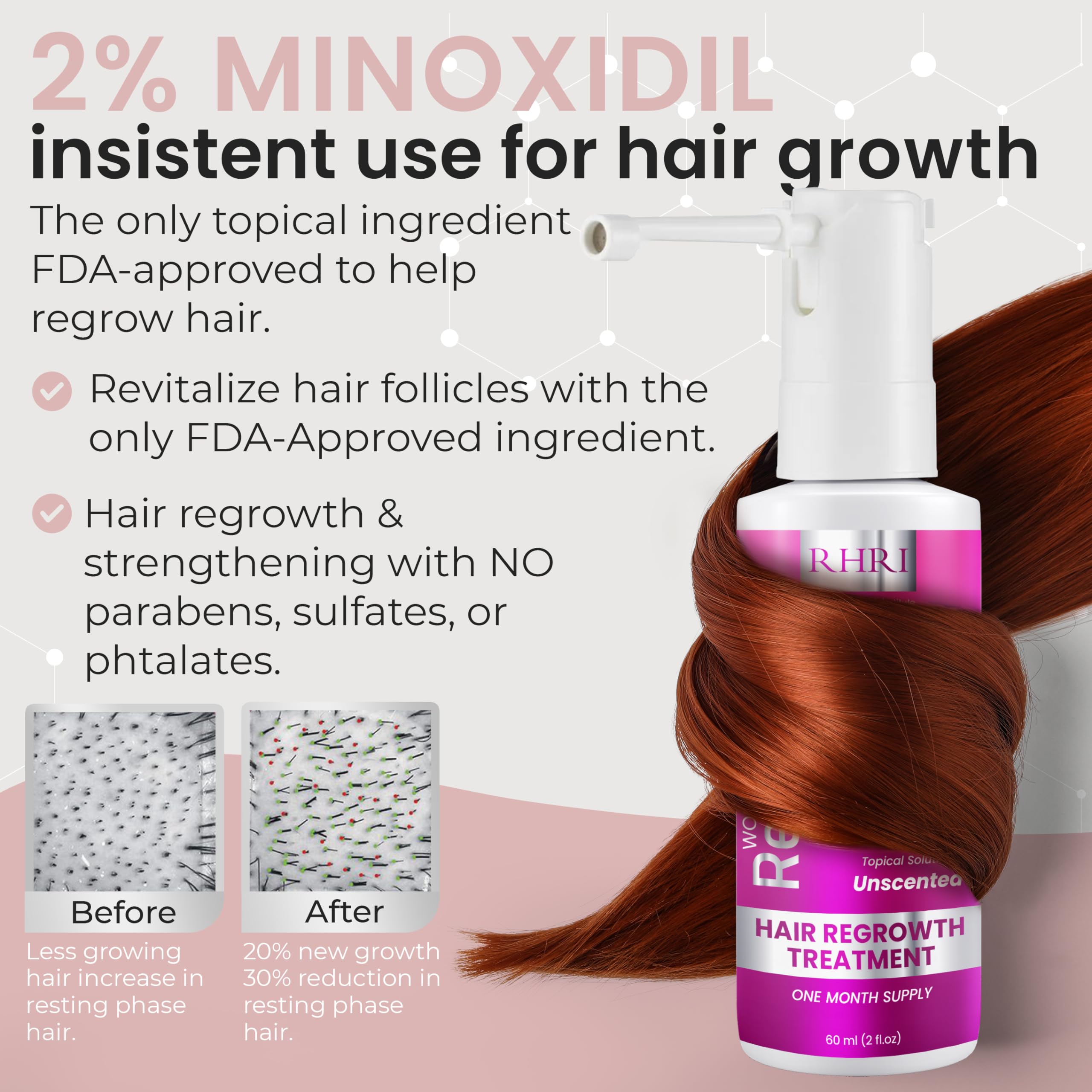 Rida Hair Minoxidil spray mist dispensing for even scalp coverage.