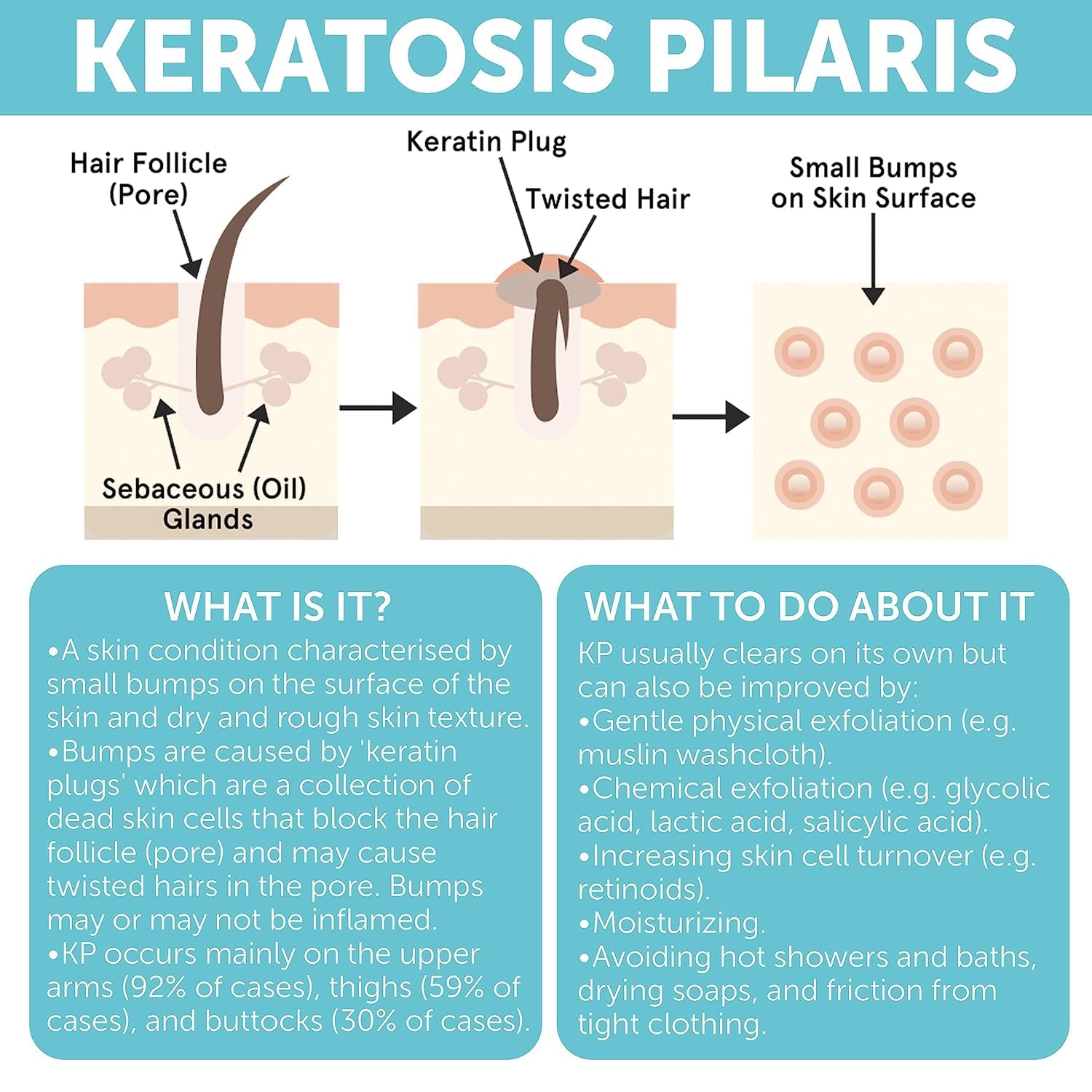 Rida Keratosis Pilaris Treatment bottle reminds daily sunscreen use.