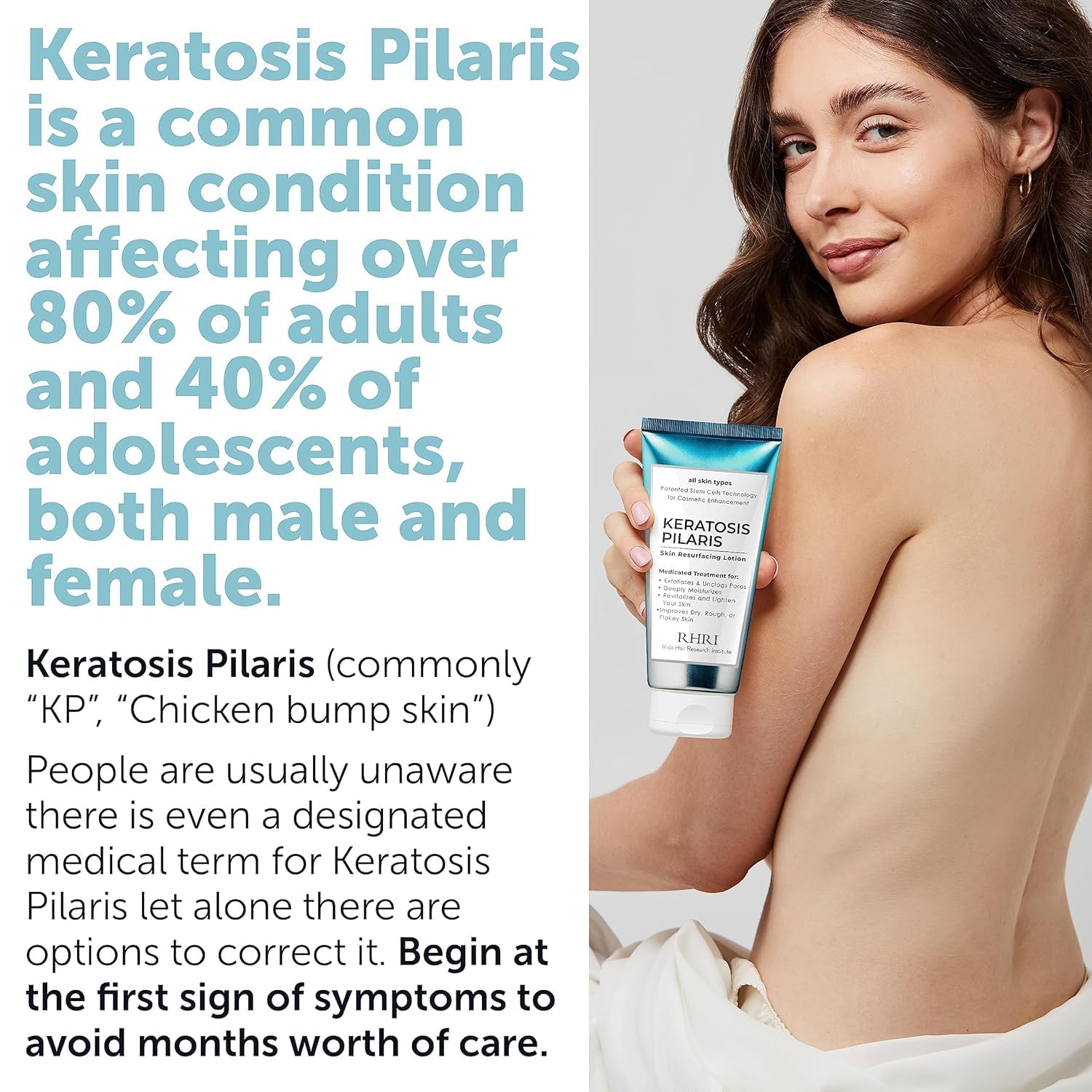 Rida Keratosis Pilaris Treatment texture close-up shows smooth cream.