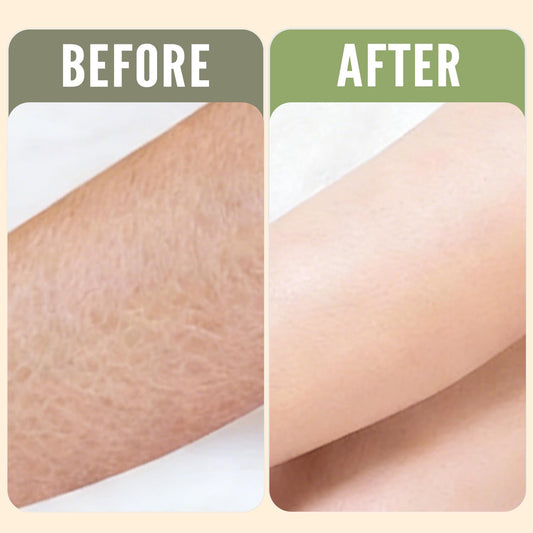 Rinse & Robust tea tree soap bar for body cleansing with cooling aroma.