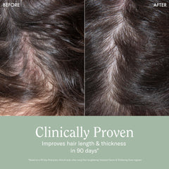 Rizos Curls Thickening Foam creates lift and volume.