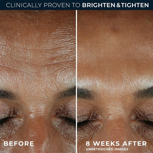 RoC cooling-stick close-up for a touchless under-eye glide.
