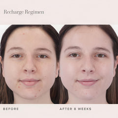 RODAN + FIELDS Recharge Australian lime pearl close-up shows exfoliation and balance.