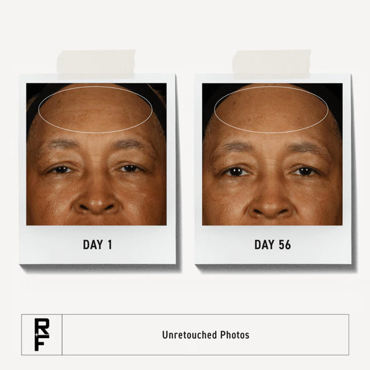 Rodan + Fields redefine toner close-up shows pore tightening and even tone