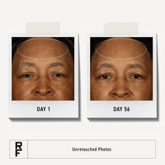 Rodan + Fields redefine toner close-up shows pore tightening and even tone