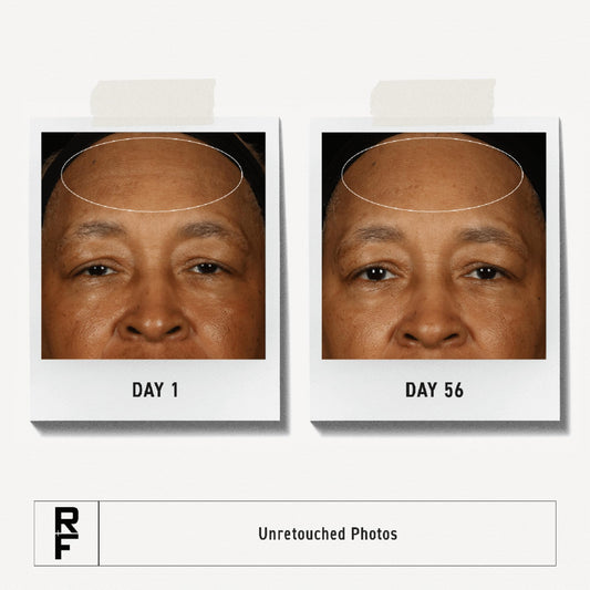 RODAN + FIELDS Step 3 PM bottle close-up highlighting premium packaging