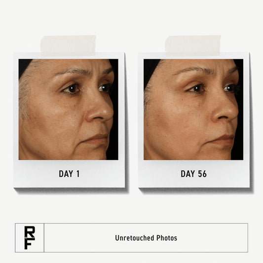 Rodan + Fields Total RF Serum pump shown for effortless application.