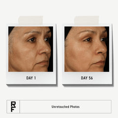 Rodan + Fields Total RF Serum pump shown for effortless application.