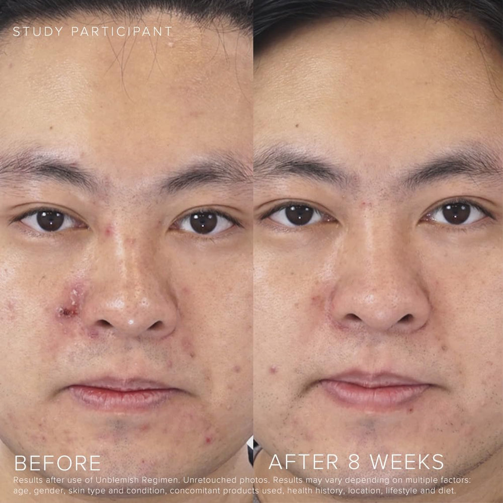 Applying Rodan + Fields UNBLEMISH Invisible Matte Defense SPF 30 on hand