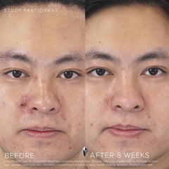 Applying Rodan + Fields UNBLEMISH Invisible Matte Defense SPF 30 on hand