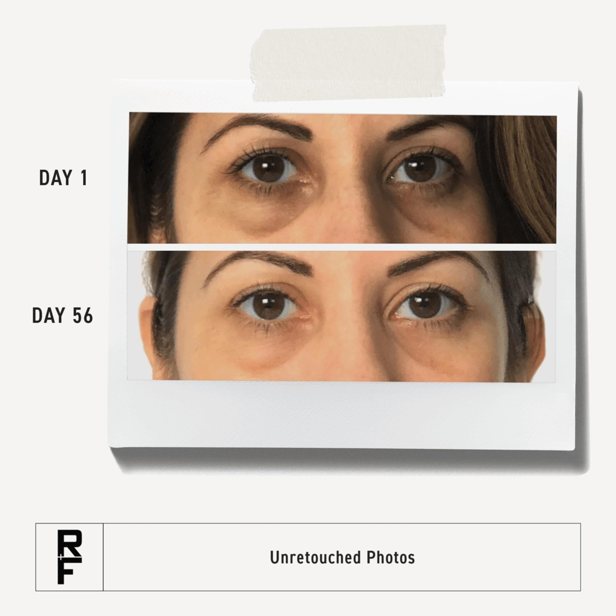 Rodan + Fields under-eye hydration with soothing botanical formula for sensitive skin.
