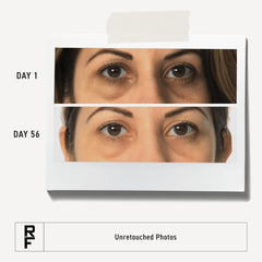 Rodan + Fields under-eye hydration with soothing botanical formula for sensitive skin.