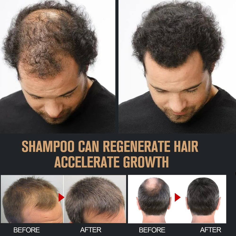 Root Activator Shampoo natural ingredients list on label, highlighting plant-based care.